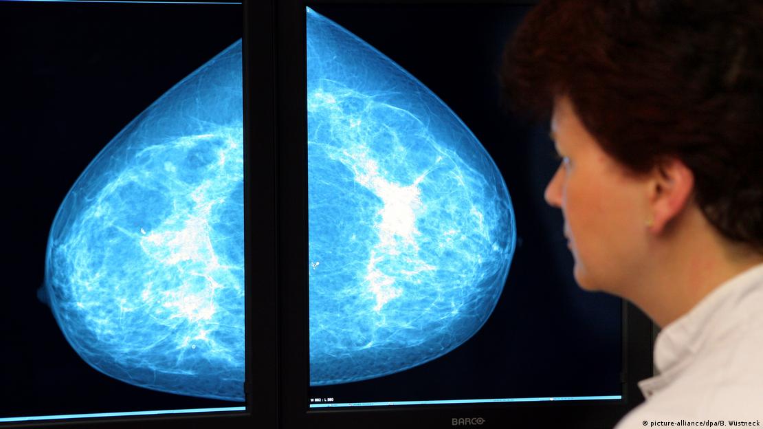 Bir mamagrofi görüntüsünü inceleyen hekim