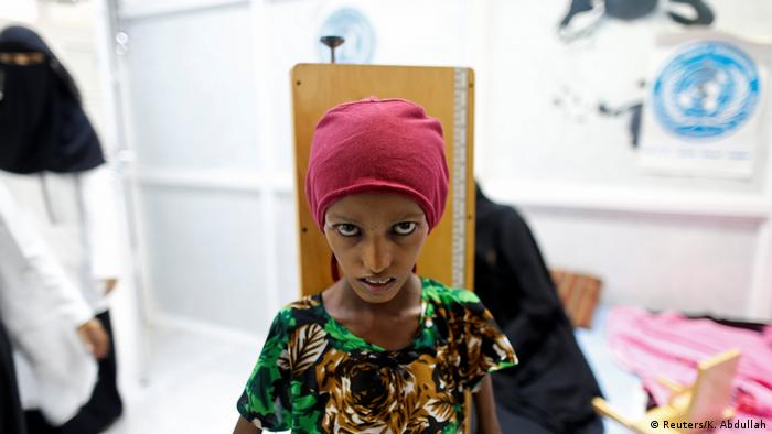 Jemen Unterernährung Saida Ahmad Baghili (Reuters/K. Abdullah)