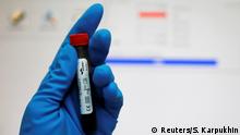 24.05.2016
A technician holds a test tube with a blood sample at the Russian anti-doping laboratory in Moscow, Russia, May 24, 2016. REUTERS/Sergei Karpukhin/File Photo