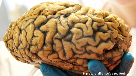 Menschliiches Gehirn (picture-alliance/dpaW. Grubitzsch)