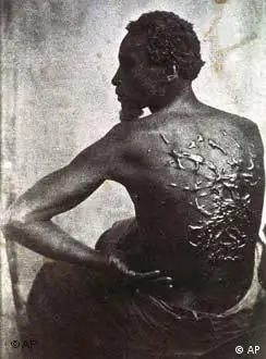 1863年拍摄的一张逃亡奴隶照片