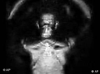 X-Ray image showing the outline of a man's head and neck