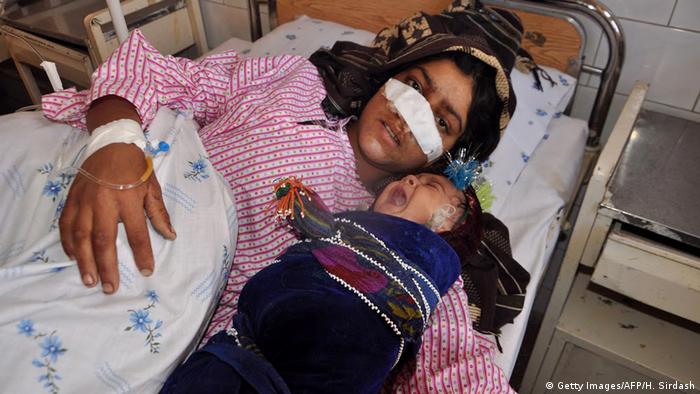 Afghanistan misshandelte Frau im Krankenhaus in Faryab (Getty Images/AFP/H. Sirdash)