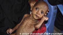 تقرير: خطر المجاعة يهدد اليمن ونقص الغذاء في العراق وسوريا
