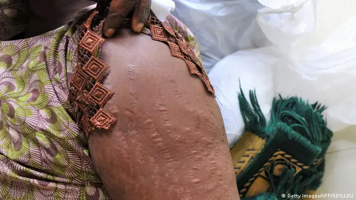 Afrika Folgen von Skin-Bleaching