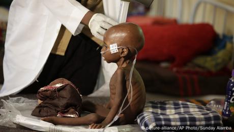 Nigeria Ärtze ohne Grenzen versorgen Kinder in Maiduguri