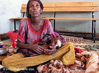 ARCHIV - Eine Mutter hält im Krankenhaus von Gode in Äthiopien ihr an Tuberkulose erkranktes, unterernährtes Baby im Arm (Archivfoto vom 08.04.2000, , Illustration zum Thema Kindersterblichkeit). Im weltweiten Kampf gegen die Kinder- und Müttersterblichkeit fehlt das Geld. Um die jährlich mehr als zehn Millionen Todesfälle in den 68 am stärksten betroffenen Ländern wirkungsvoll zu verringern, sind nach Ansicht von UN-Experten mindestens 10 Milliarden US-Dollar pro Jahr zusätzlich nötig. 2006 habe die internationale Gemeinschaft für diese Aufgabe 3,5 Milliarden US-Dollar (2,2 Milliarden Euro) zur Verfügung gestellt, heißt es in einem am Mittwoch (16.04.2008) in Kapstadt (Südafrika) veröffentlichten Bericht. Das seien nur drei Prozent der weltweiten Entwicklungshilfe-Ausgaben. Foto: Joel Robine (zu dpa 0271 vom 16.04.2008) +++(c) dpa - +++