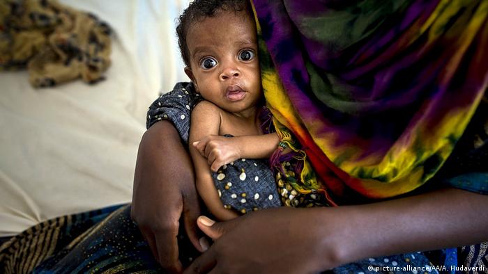 Somalia Krise - Hungersnot und Cholera