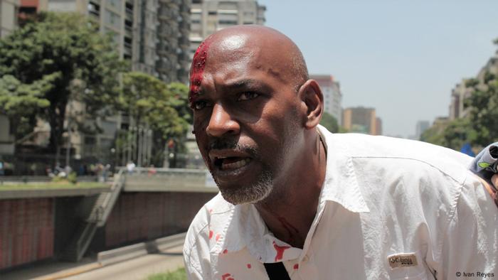 Lino Rivera, herido por una piedra.
