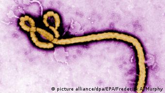 The Ebola virus under a microscope
