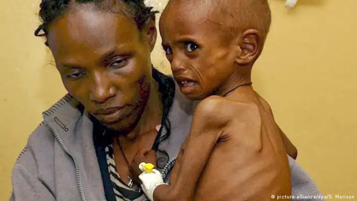 Äthiopien Ein unterernährtes Kind wartet mit seiner Mutter im Krankenhaus