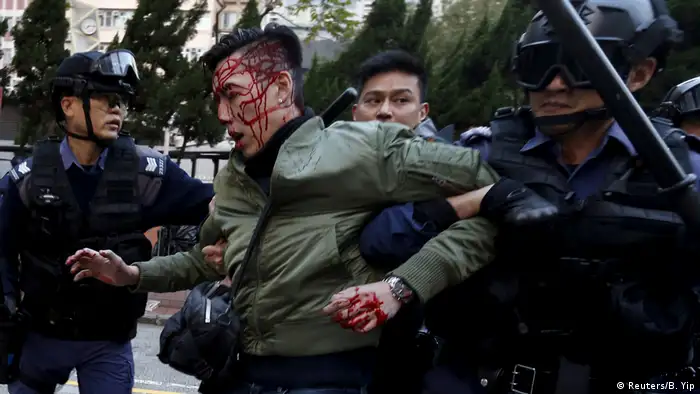 2016: Another bout of violence
In February 2016, Hong Kong's rough police tactics made headlines again. Authorities tried to remove illegal street vendors from a working-class Hong Kong neighborhood. They sent riot police, who used batons and pepper spray against protesters, and also fired live warning shots into the air. The street clashes were the worst since the Umbrella Revolution in 2014.