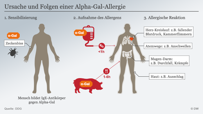 Infografik Alpha-Gal-Allergie