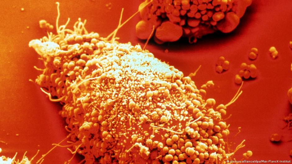 England startet weltweit erstes Impfprogramm gegen Tripper