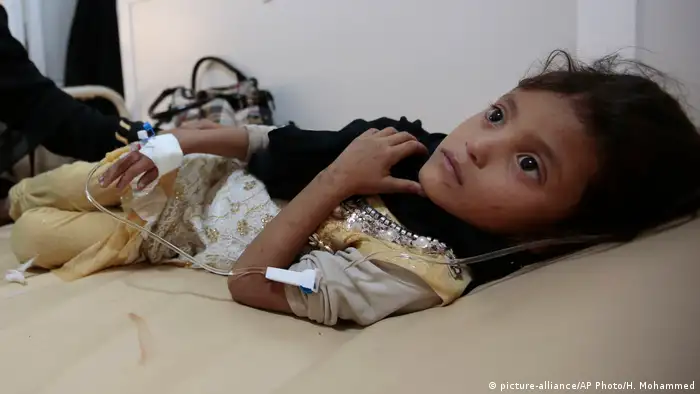 Jemen Krankes Kind in einem Krankenhaus in Sanaa (picture-alliance/AP Photo/H. Mohammed)