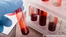 هل يمكن إنتاج الدم صناعيا؟