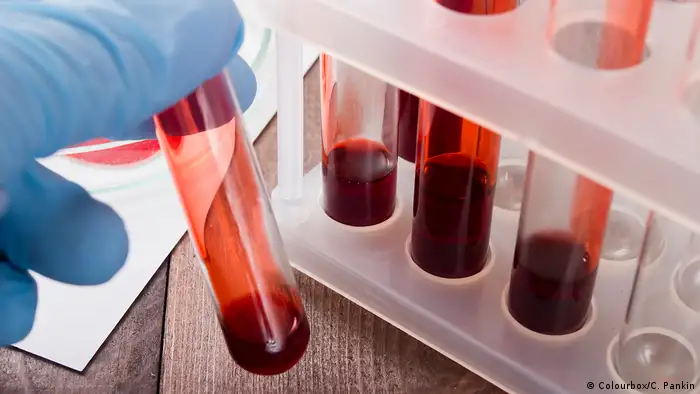 Un grupo de investigadores ha logrado un método para desarrollar rápidamente anticuerpos humanos específicos en el laboratorio que puede ayudar a combatir enfermedades infecciosas y otras como el cáncer. (25.07.2017)