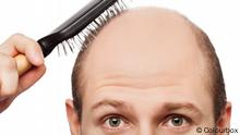 Human alopecia or hair loss - adult man hand holding comb on bald head