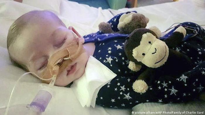 Con once meses de vida muere el bebé Charlie Gard | Europa | DW | 28.07.2017