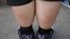 Obes kid's chubby legs Obes kid's chubby legs