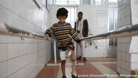 A young boy who lost his leg due to Yemen's conflict uses a prosthetic limb at a government-run rehabilitation center