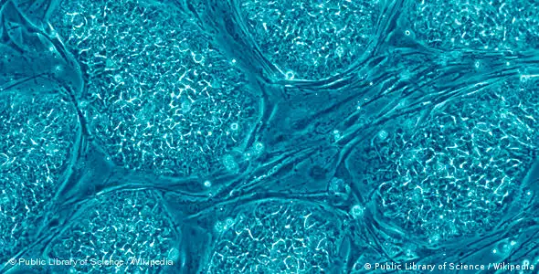Menschliche embryonale Stammzellen (Foto: Public Library of Science/Wikipedia)