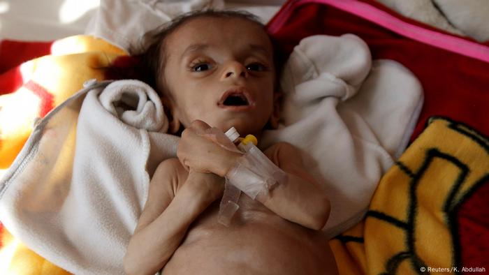Jemen Hunger Symbolbild Kind in Sanaa (Reuters/K. Abdullah)