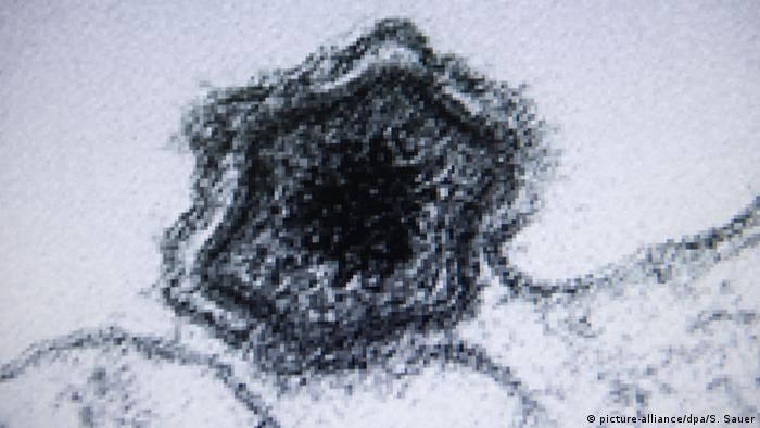 The African swine fever Virus seen under a microscope