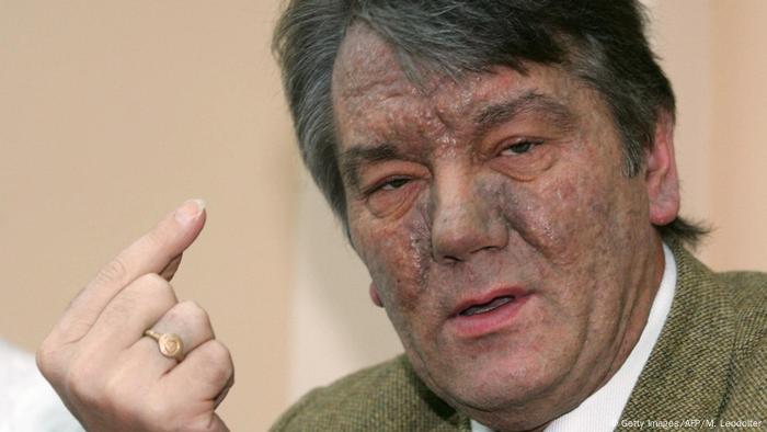 Viktor Yushchenko (Getty Images/AFP/M. Leodolter)