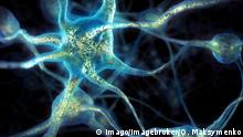 Forscher entdecken Genmutation gegen Alzheimer 