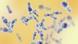 Clostridium bacteria Clostridium bacteria