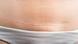 Nem todas as feridas da intervenção são tão fáceis de sarar Nem todas as feridas da intervenção são tão fáceis de sarar