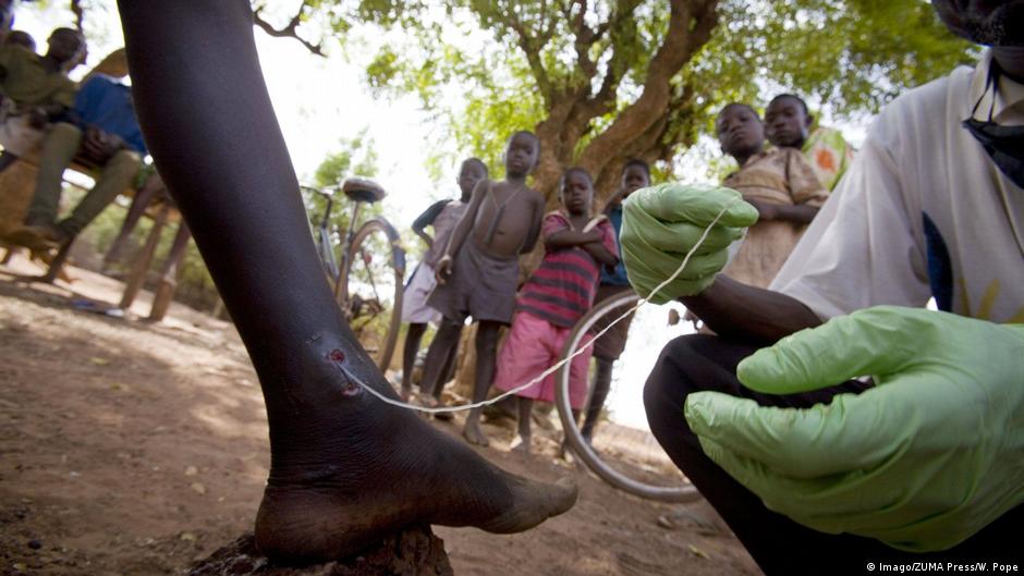 Guinea worm: inching towards eradication – DW – 05/23/2018