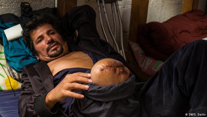 Ein Mann mit einem amputierten Bein in einem Flüchtlingslager (Foto: DW/S. Derks)
