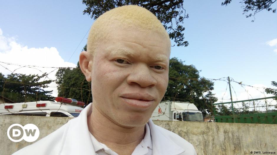 Berburu penderita albinisme – DW – 12 Juni 2023