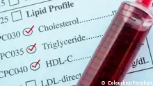 ارتفاع الكوليسترول: انتبه لهذه العلامات وتجنب هذه الأطعمة!