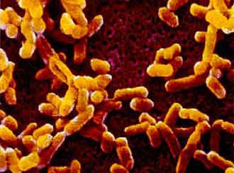 Yersinia Pestis : une bactérie foudroyante