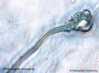 Spermien mikroskop Bei welcher