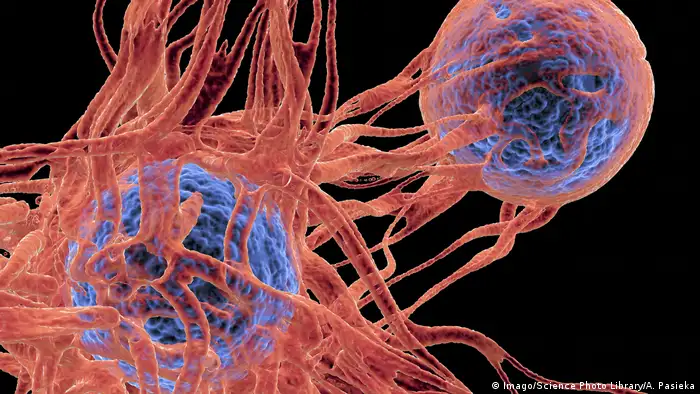Melanoma - Hautkrebs - Illustration der Krebszellen (Imago/Science Photo Library/A. Pasieka)