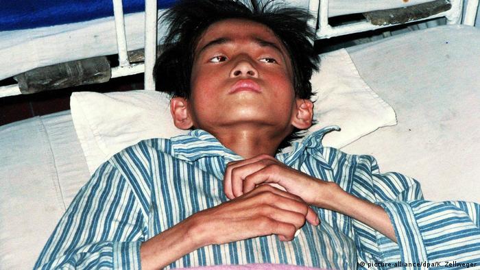  A severly malnourished 15-year-old lies in a hospital bed in famine-stricken North Korea in 1998