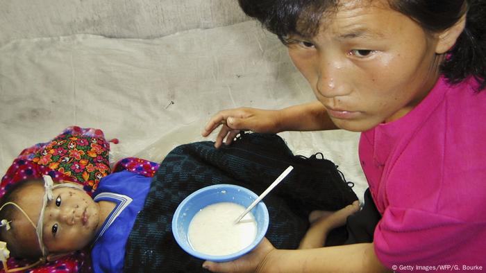 Un niño norcoreano desnutrido, de 3 años, recibe una papilla enriquecida con vitaminas y minerales suministrada por el Programa Mundial de Alimentos de las Naciones Unidas.