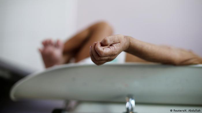 A malnourished boy lies on a weighing scale at the malnutrition ward of Al-Sabeen hospital in Sanaa