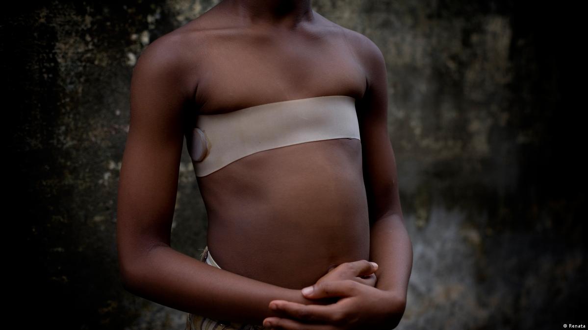 The fight against breast ironing in Cameroon – DW – 10152018