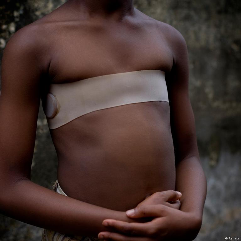 Choti Girls Or Boys Sex - The fight against breast ironing in Cameroon â€“ DW â€“ 10/15/2018