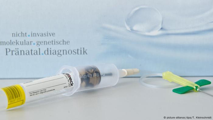 Down-Syndrom-Bluttest
