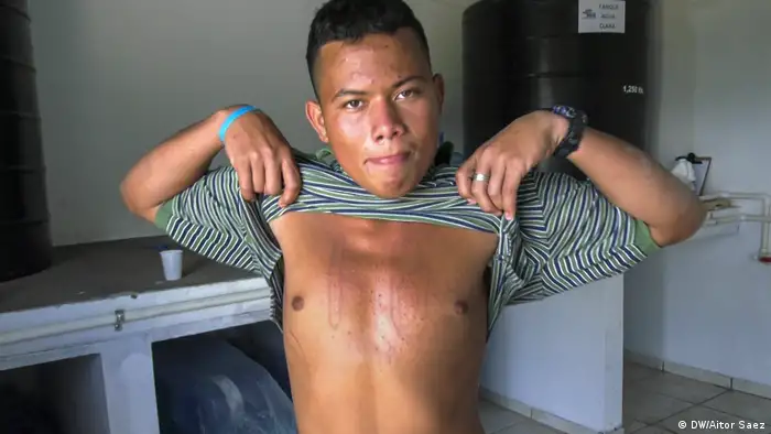 Joven muestra el pecho. (DW/Aitor Saez)