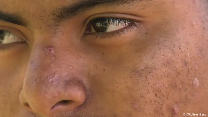 Rostro de joven (DW/Aitor Saez)