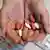 An HIV-positive child holds pills in his outstretched hands