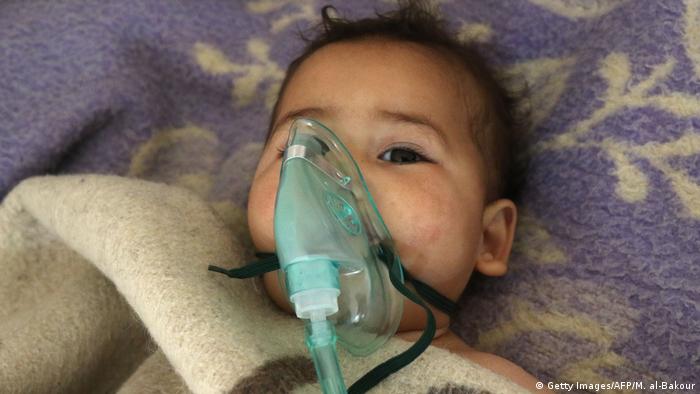 Niño víctima de ataque con gas por parte de tropas de Asad en Khan Sheikhun, cerca de Idlib, el 4 de abril de 2017.