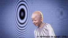 Antony Kakuki, 7, walks on a runway during a rehearsal session prior to take part in the Mr and Miss Albinism East Africa pageant in Nairobi, Kenya, on November 20, 2018. - 30 contestants from Kenya, Tanzania and Uganda compete under the theme Celebrating the beauty of colour to raise awareness of their challenges with albinism, including stigma and brutality. (Photo by Yasuyoshi CHIBA / AFP) (Photo credit should read YASUYOSHI CHIBA/AFP/Getty Images)